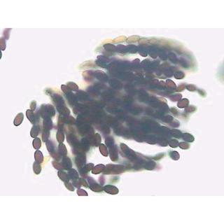 Rhizopus Stolonifer W.m. With Sporangia 