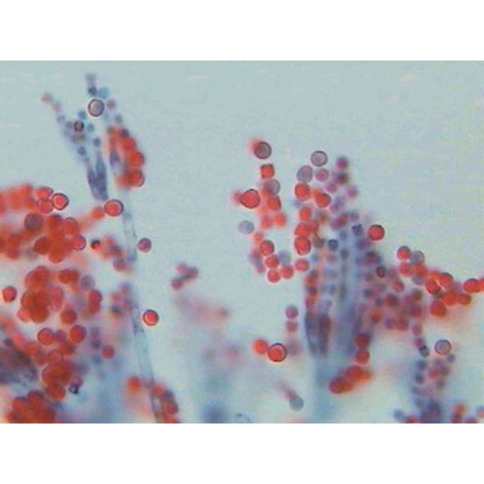Penicillium Section With Hyphae And
