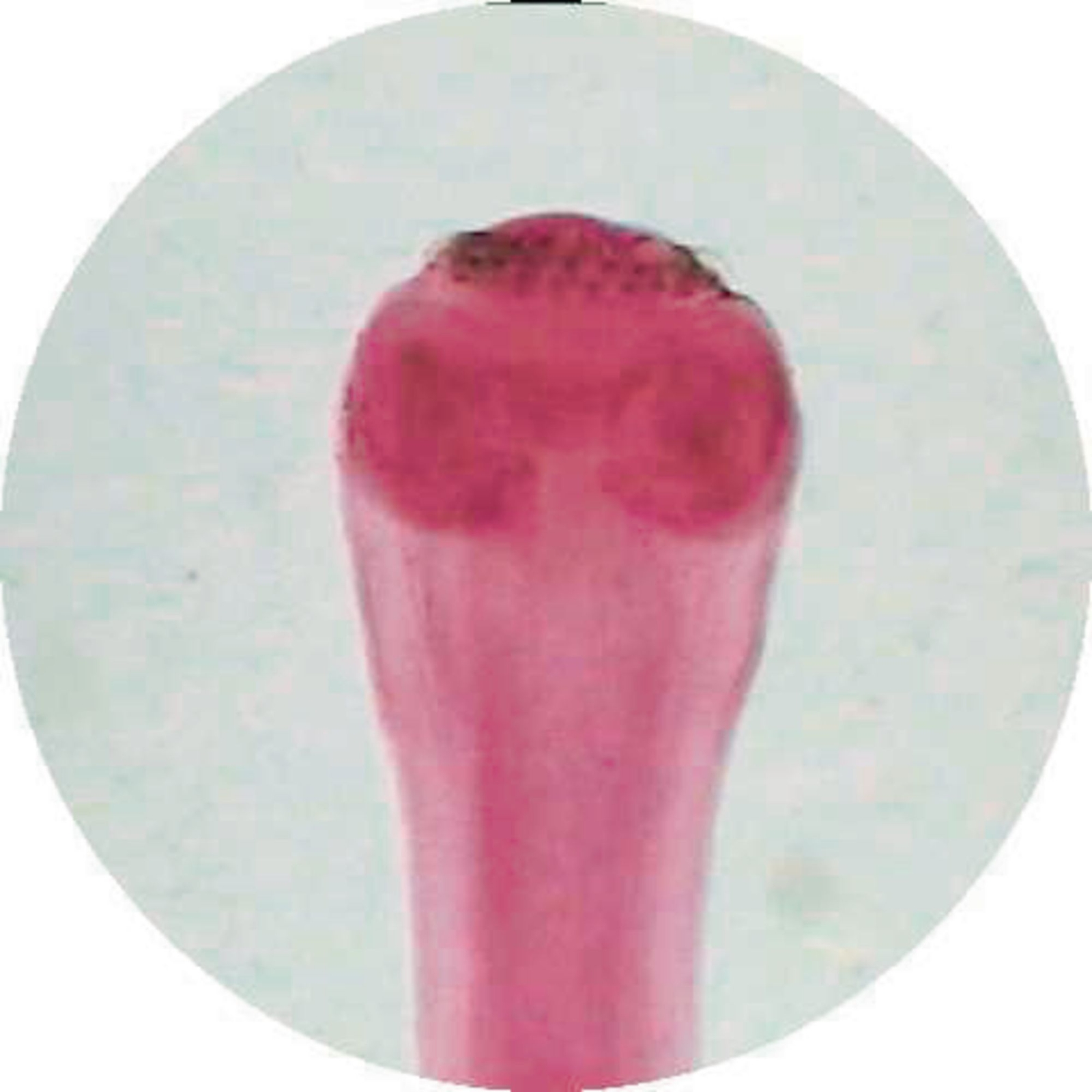 Taenia Pisiformis Cysticercus W.m.