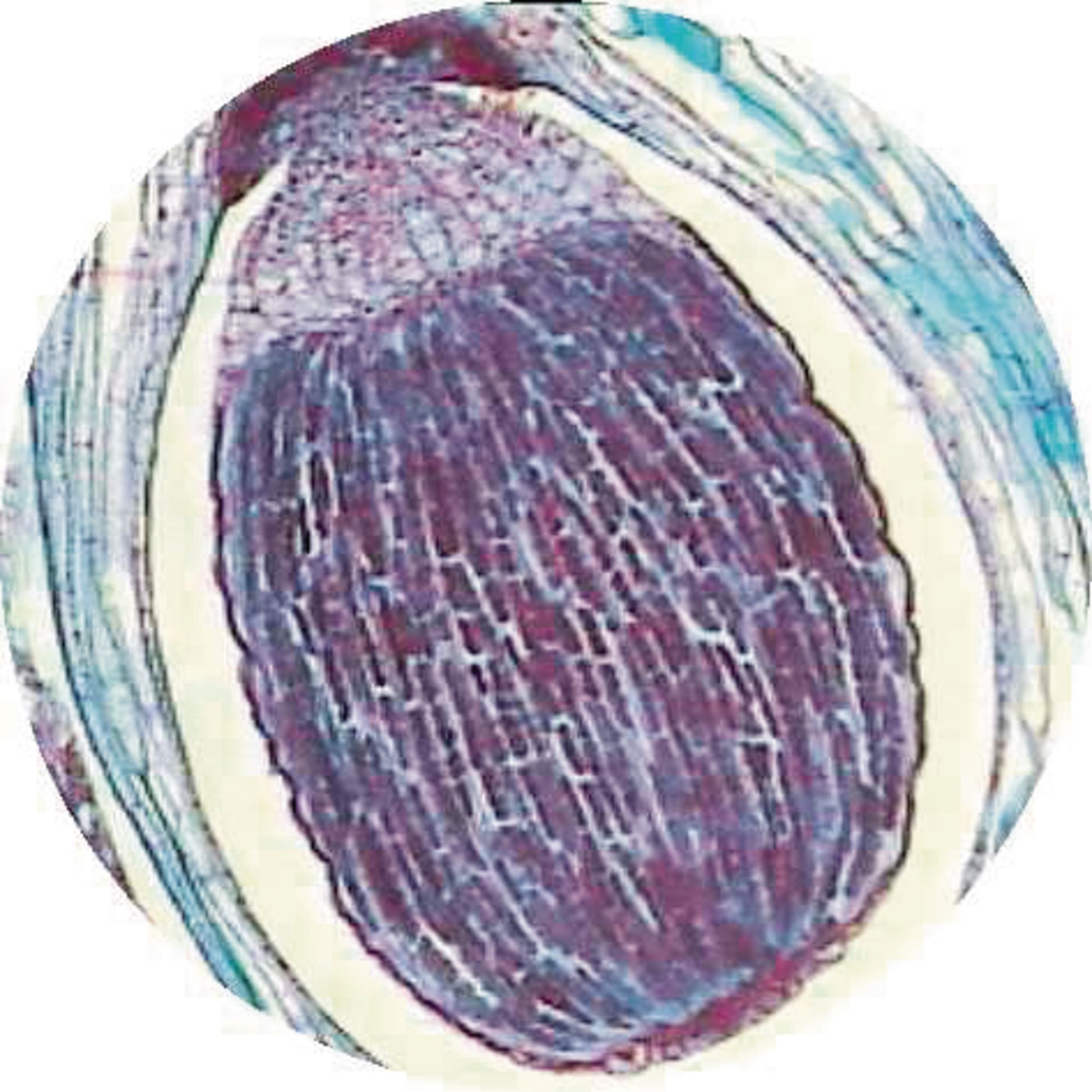 Lycopodium T.s. Stem (b.6-100)