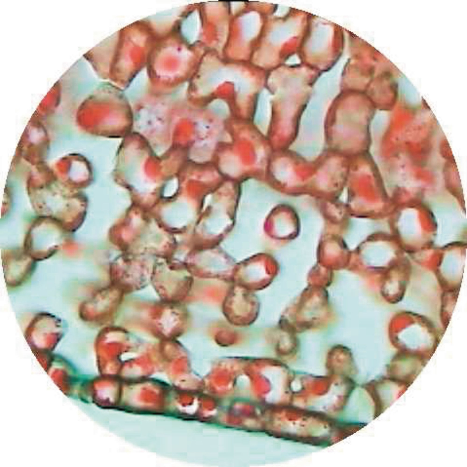 Buxus Lower Epidermis Showing Stomata