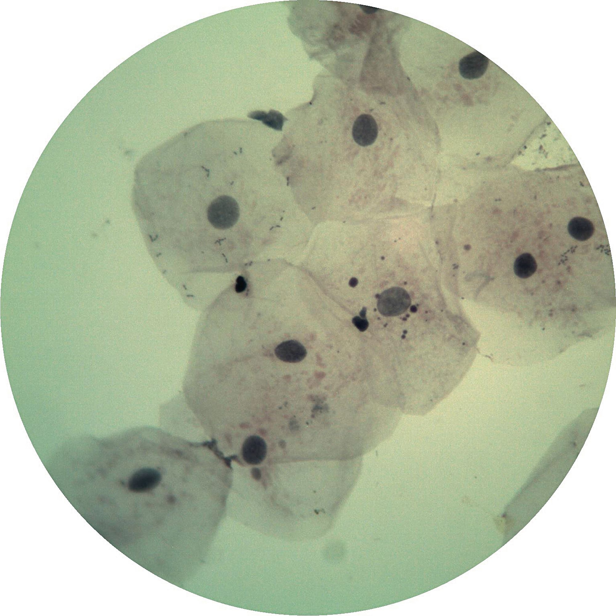 Squamous Epithelium From Human Mouth