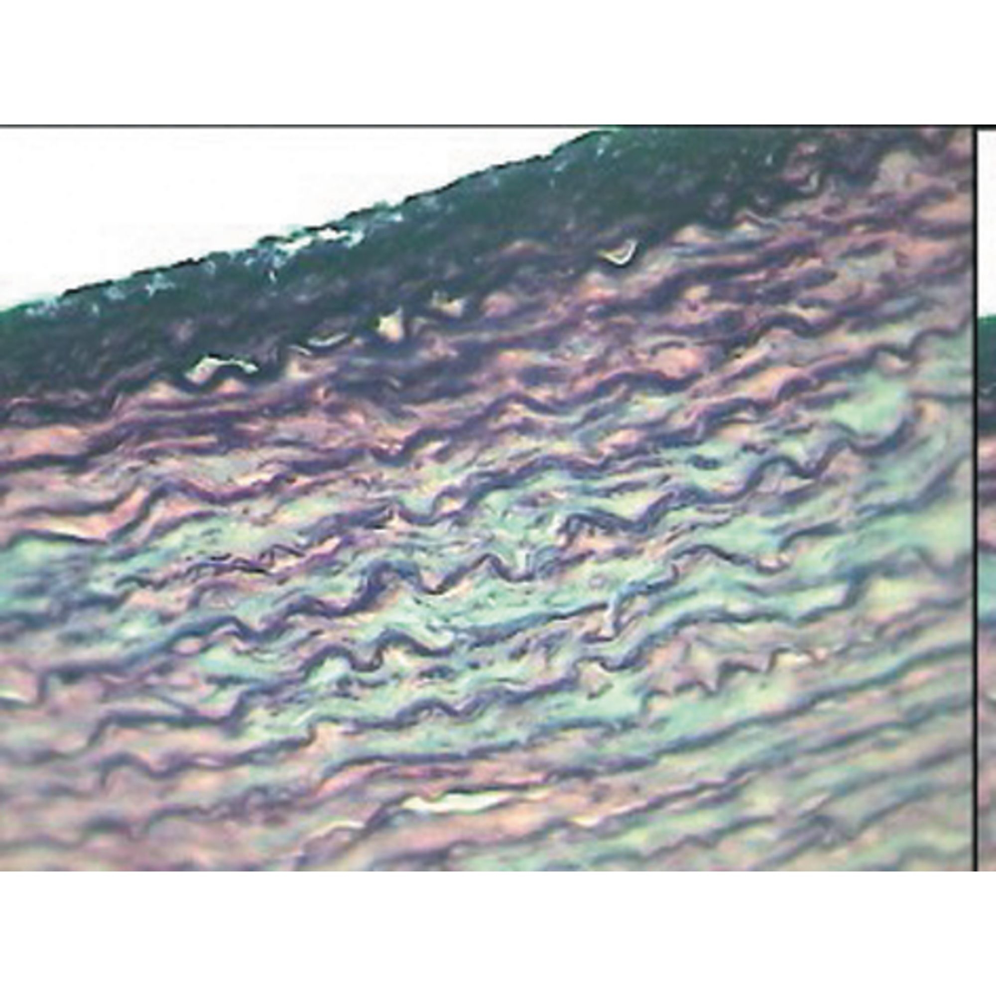Human Artery And Vein Plastic Embedded