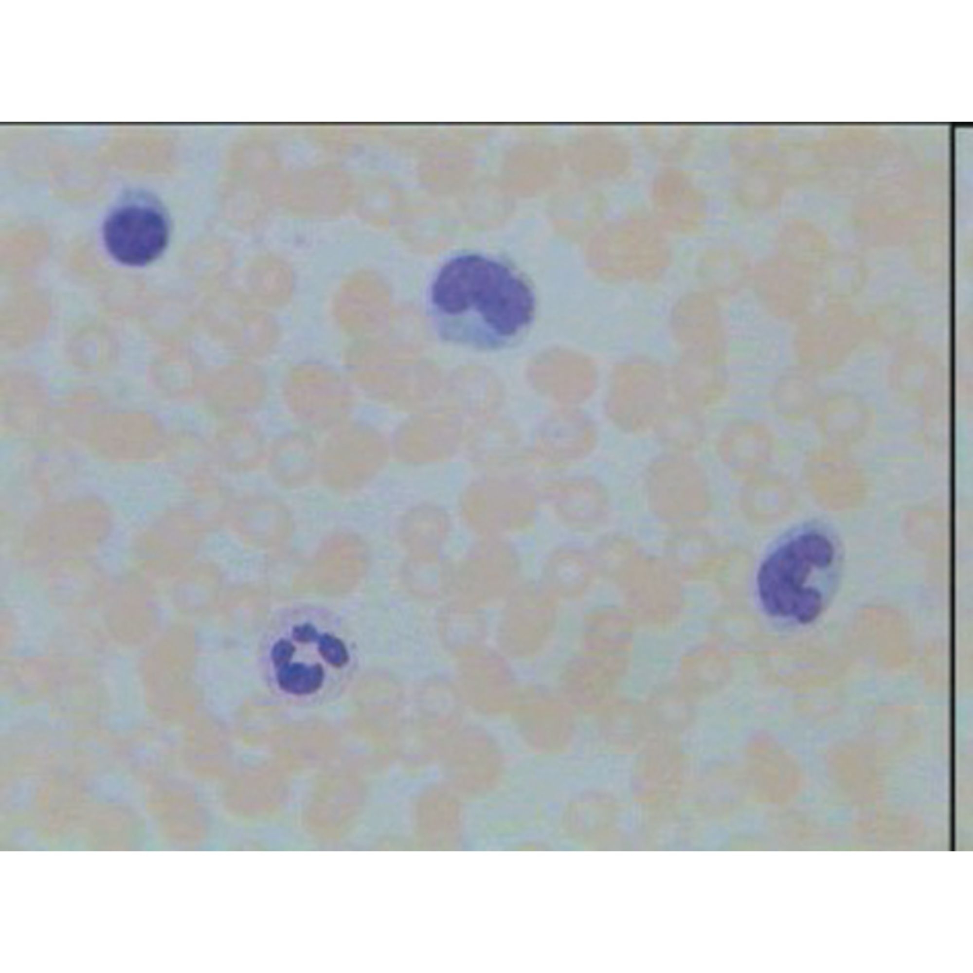 Human Blood Smear Giemsa