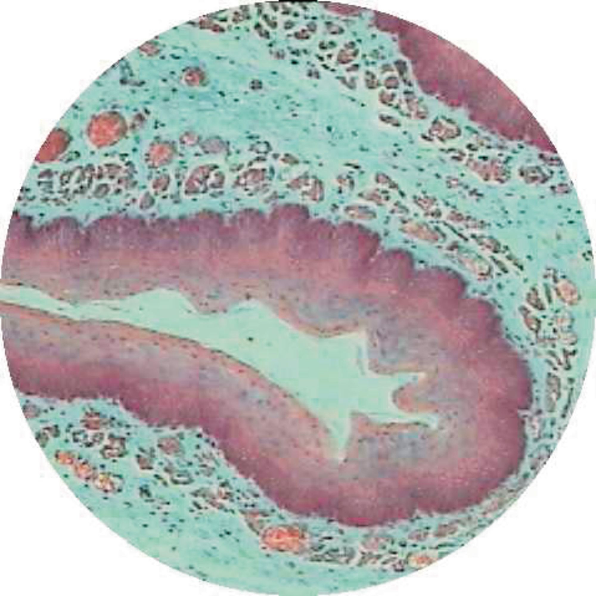 Oesophagus T.s. From Rabbit (h.7-10)