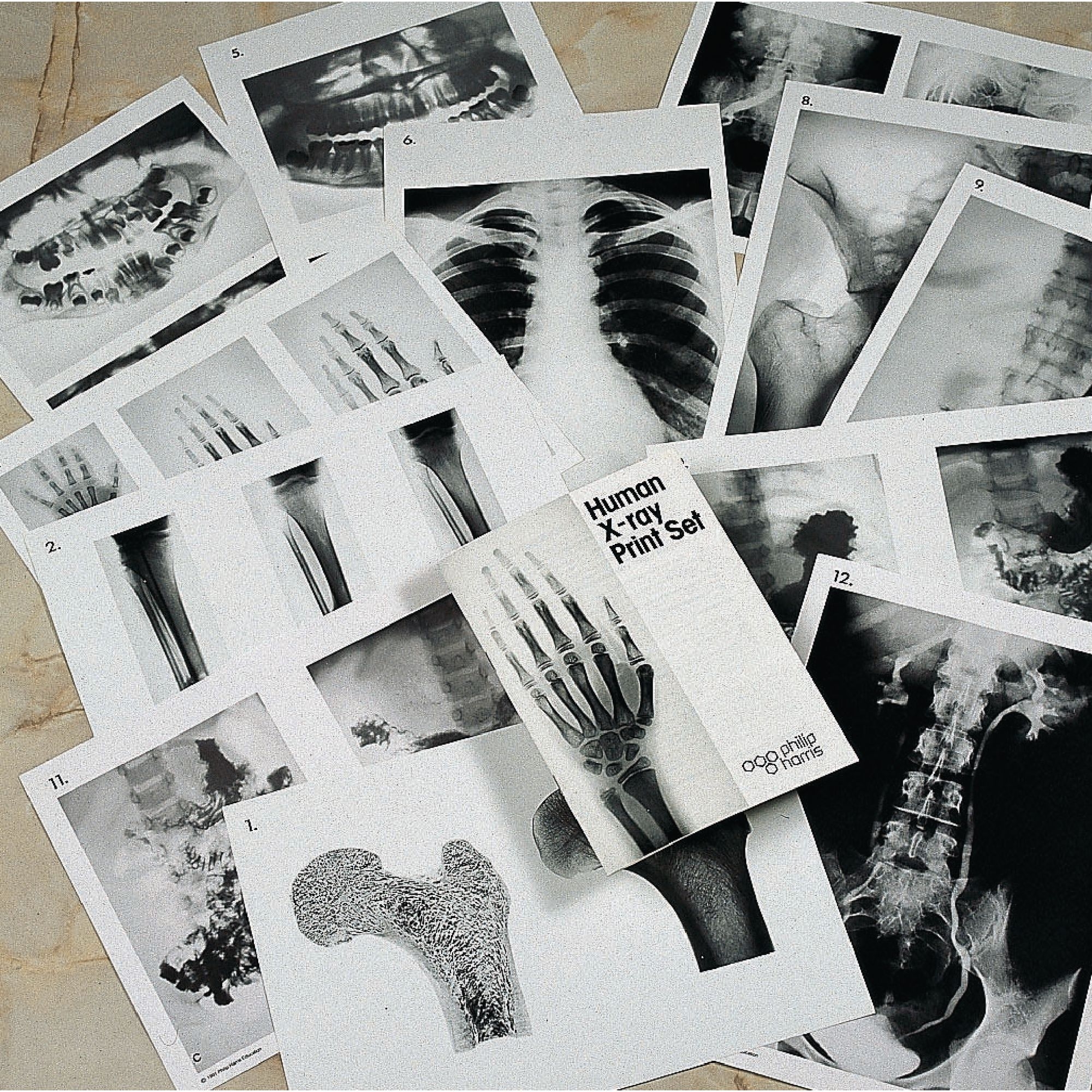 Human X-ray Print Set A3