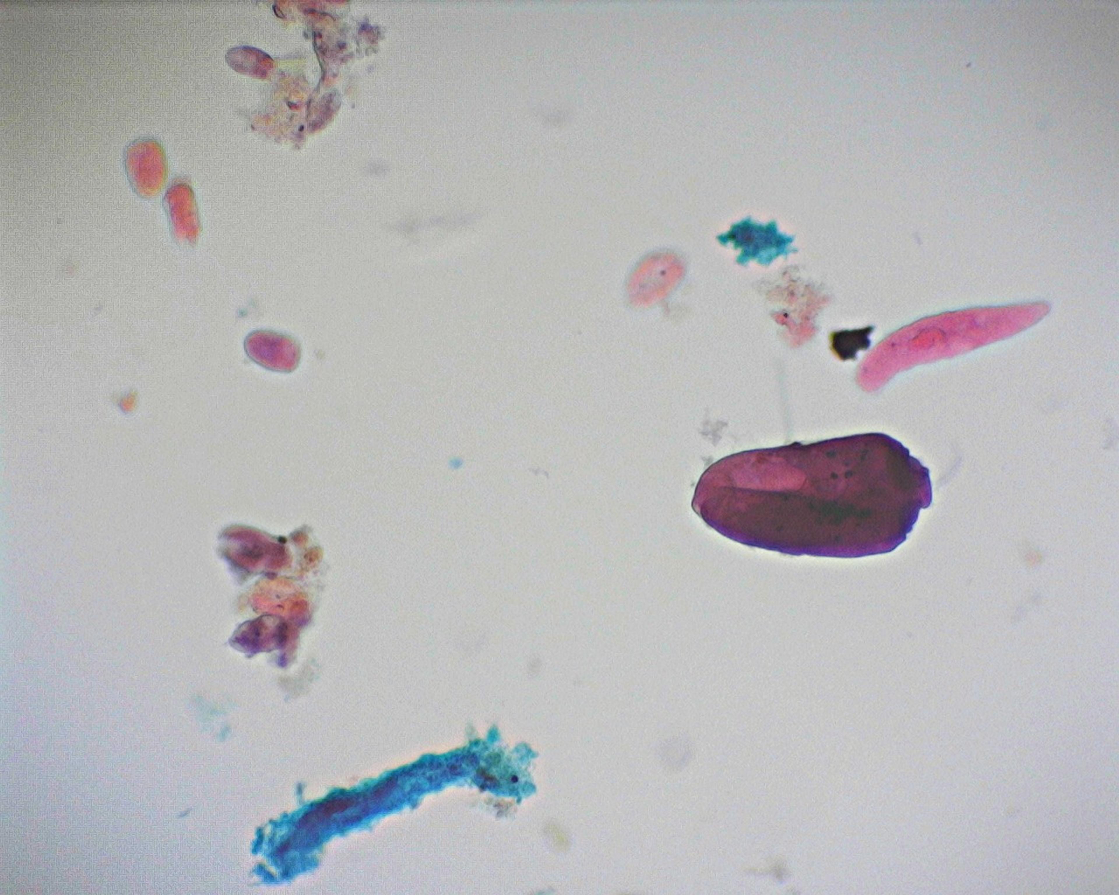 Philip Harris Prepared Microscope Slide - Mixed Protozoa W.M. 