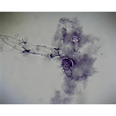 Philip Harris Prepared Microscope Slide - Amoeba proteus W.M. 
