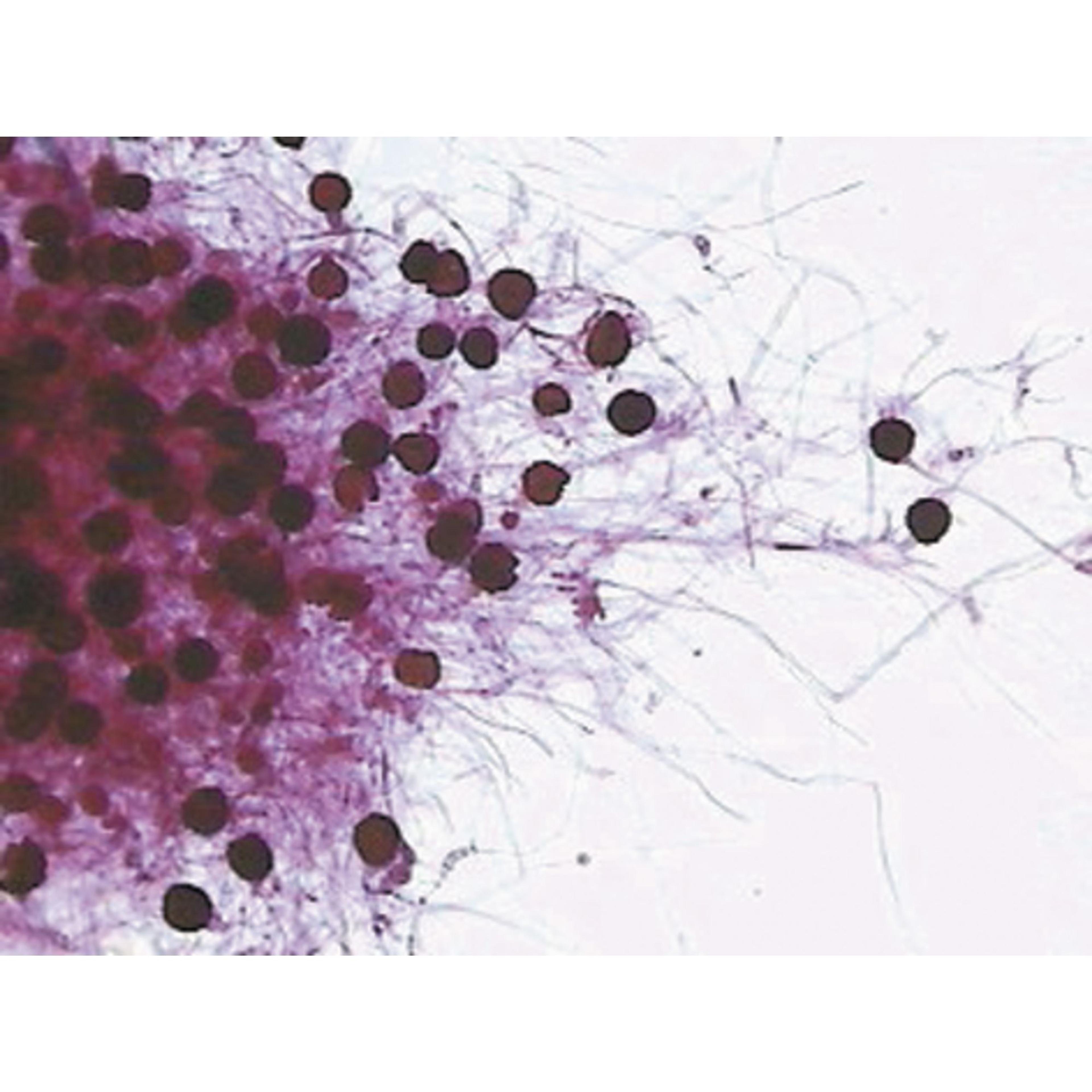 Philip Harris Prepared Microscope Slide - Bread Mould (Rhizopus stolonifer) with Sporangia W.M.