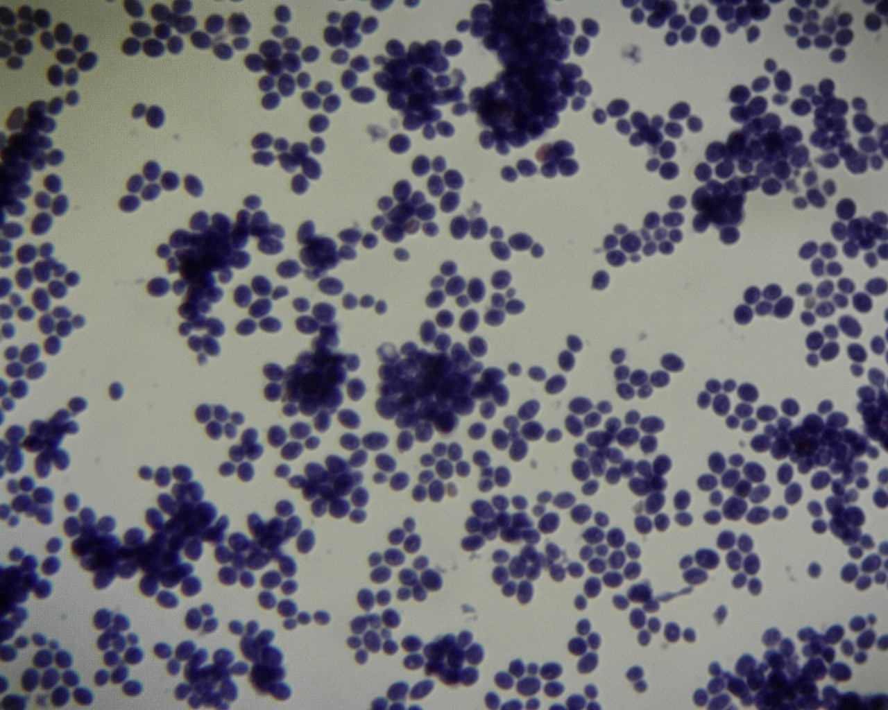 Saccharomyces Cerevisaebudding(b.2-300