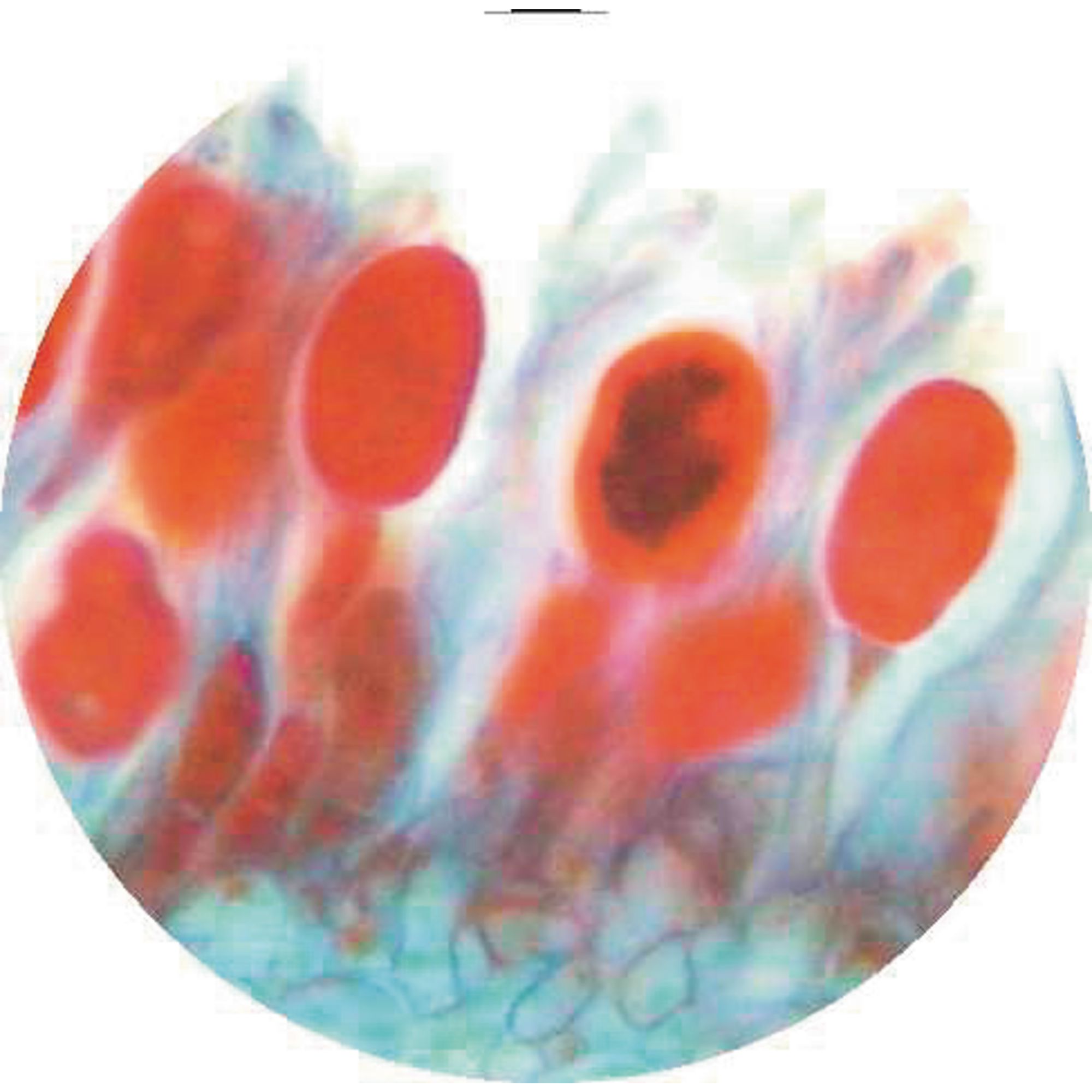 Puccinia T.s. Host With Uredospores
