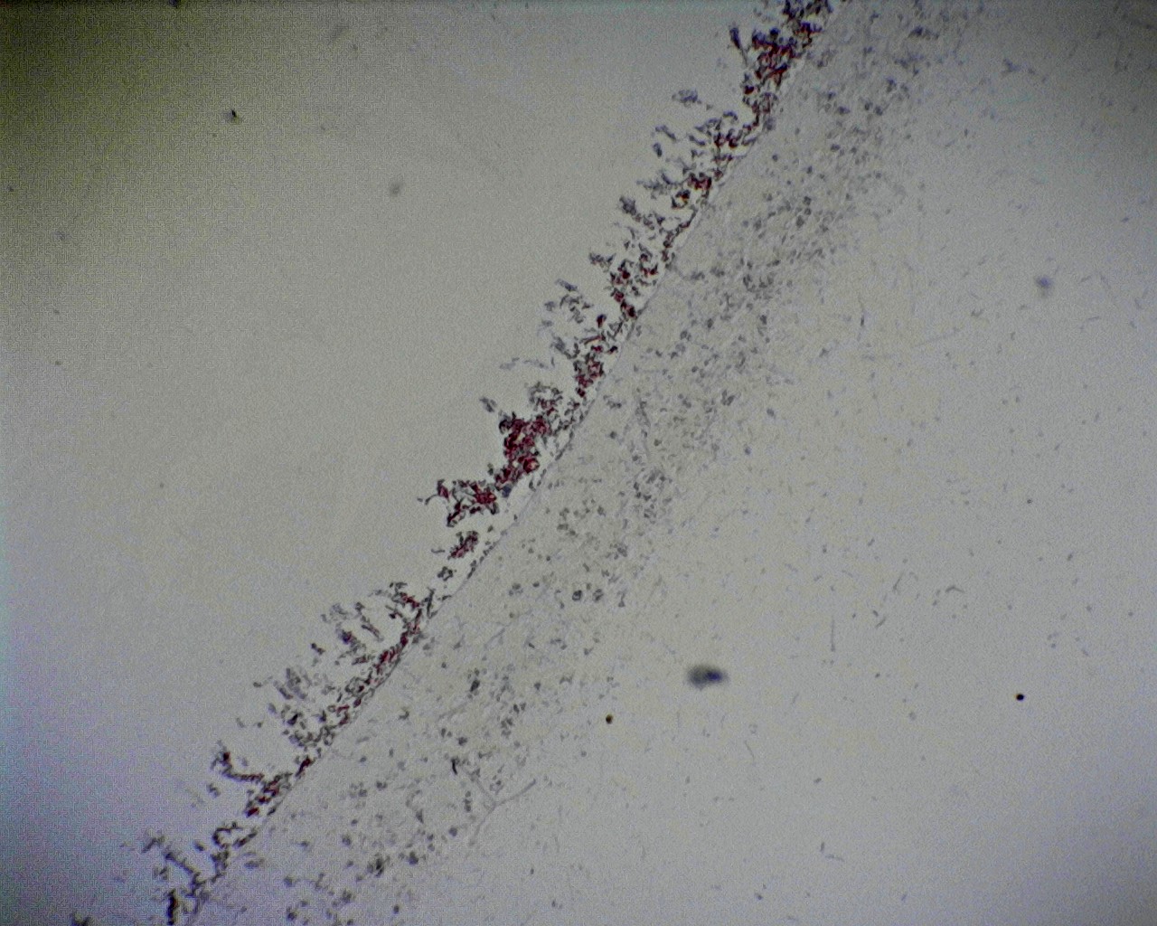 Penicillium Section With Hyphae And