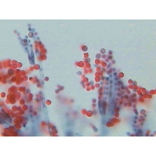 Philip Harris Prepared Microscope Slide - Aspergillus with Condiospores