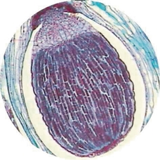 Prepared Microscope Slide - Lycopodium: Stem T.S. 