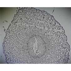 Prepared Microscope Slide  - Broad Bean (Vicia faba): Young Root Hair Region
