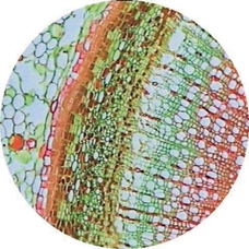 Prepared Microscope Slide - Elderberry (Sambucus): Bark with Lenticel T.S.