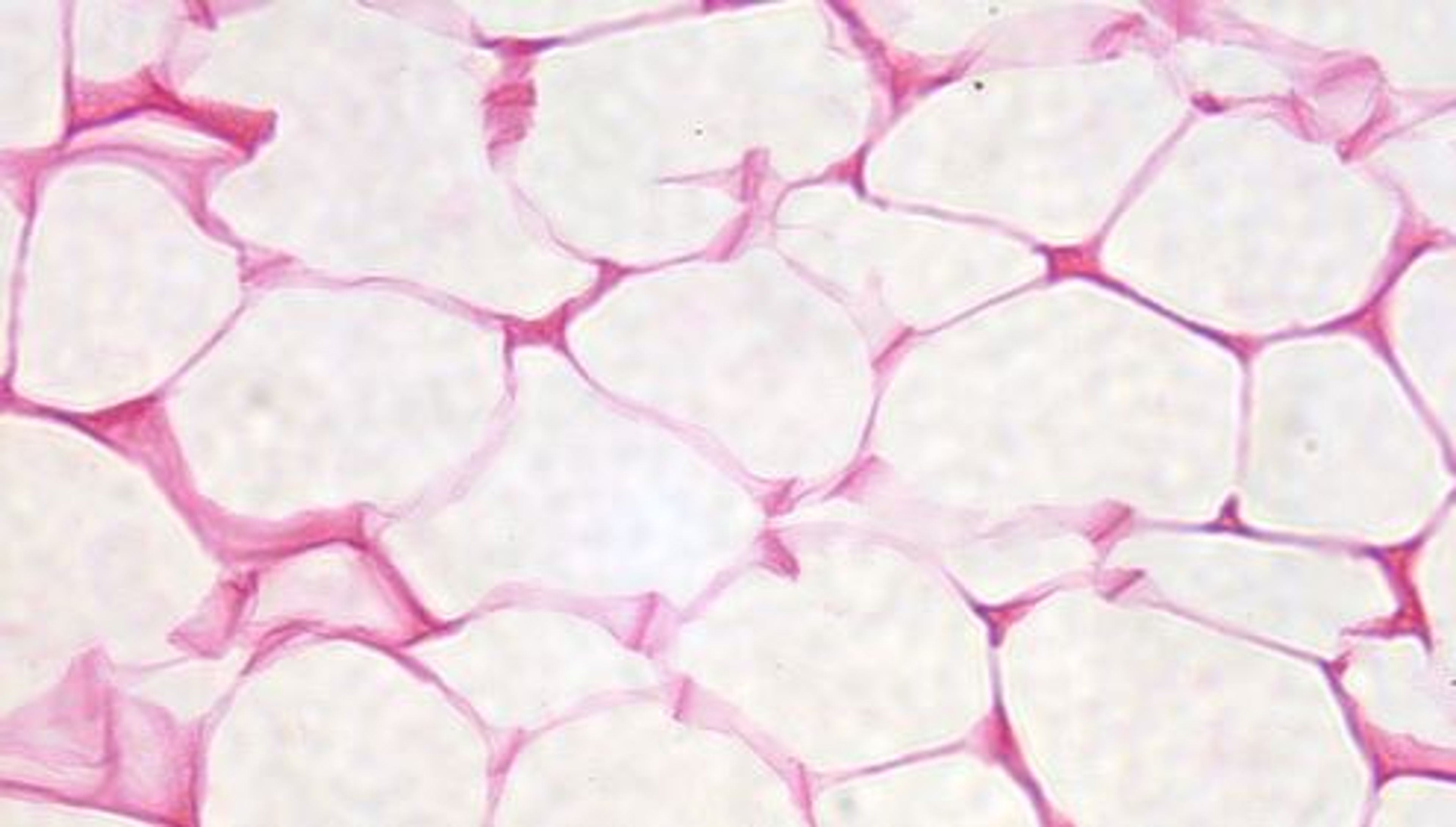 Philip Harris Prepared Microscope Slide - Adipose Tissue Section