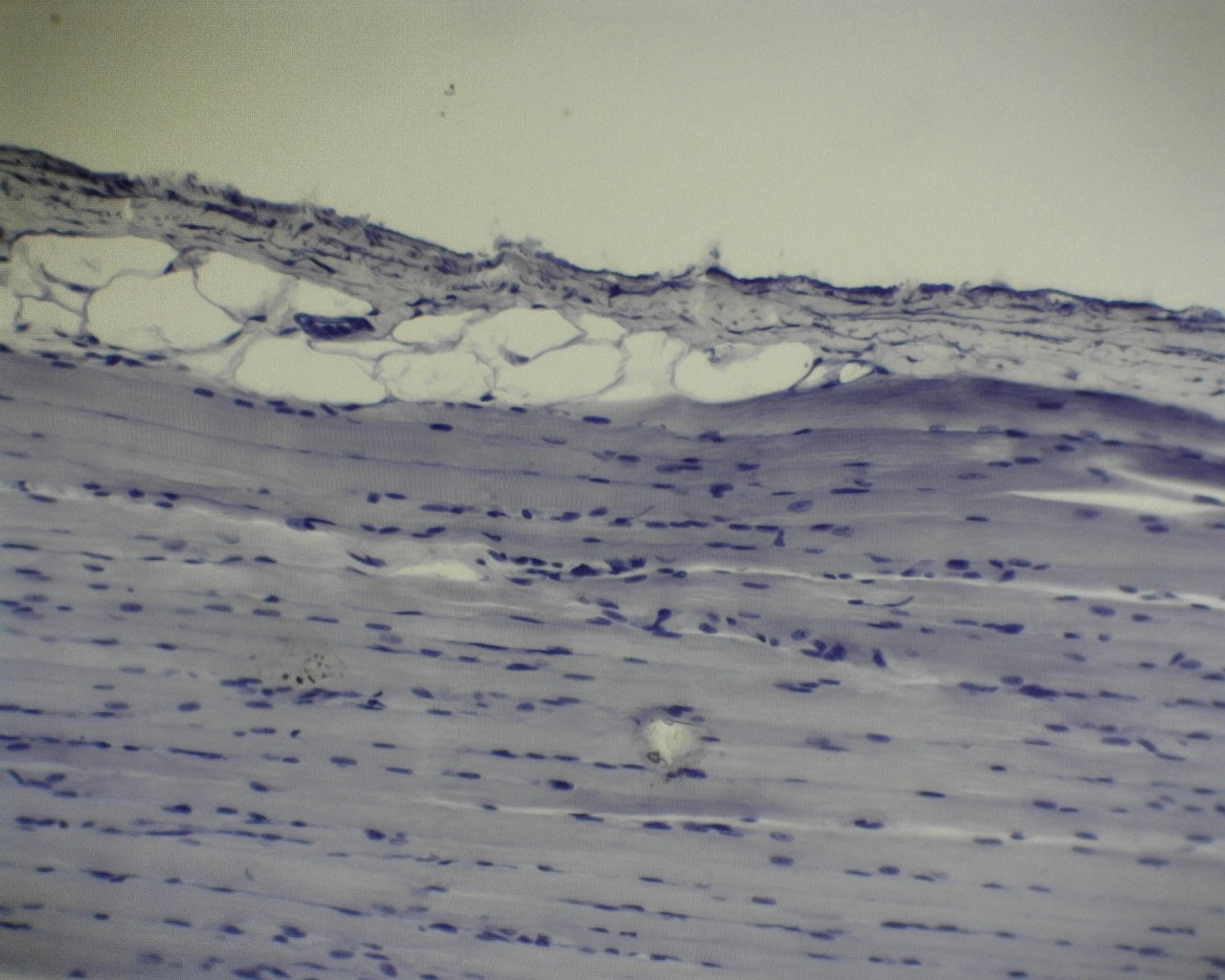 Prepared Microscope Slide - Striated Muscle: Skeletal