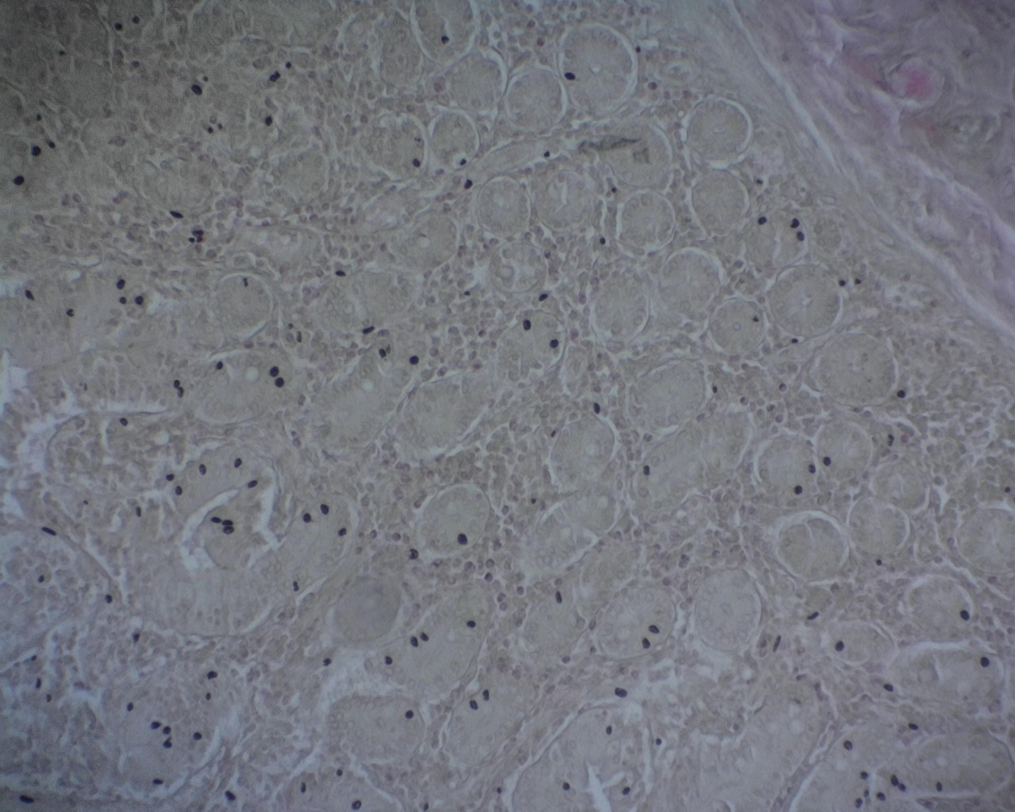 Philip Harris Prepared Microscope Slide - Non-striated (Smooth) Muscle - Intestinal Wall