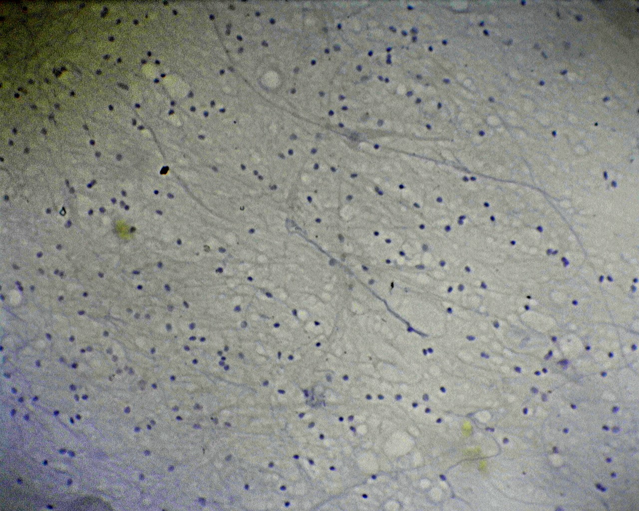 Nerve Cells Isolated Smear Of Spinal