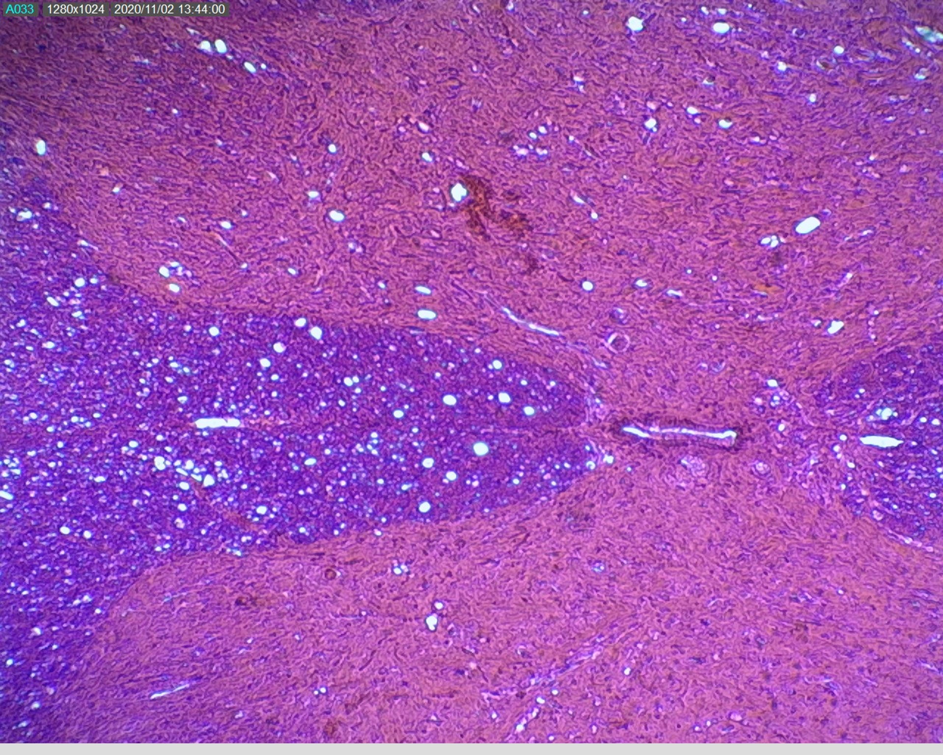 Philip Harris Prepared Microscope Slide - Spinal Cord T.S.
