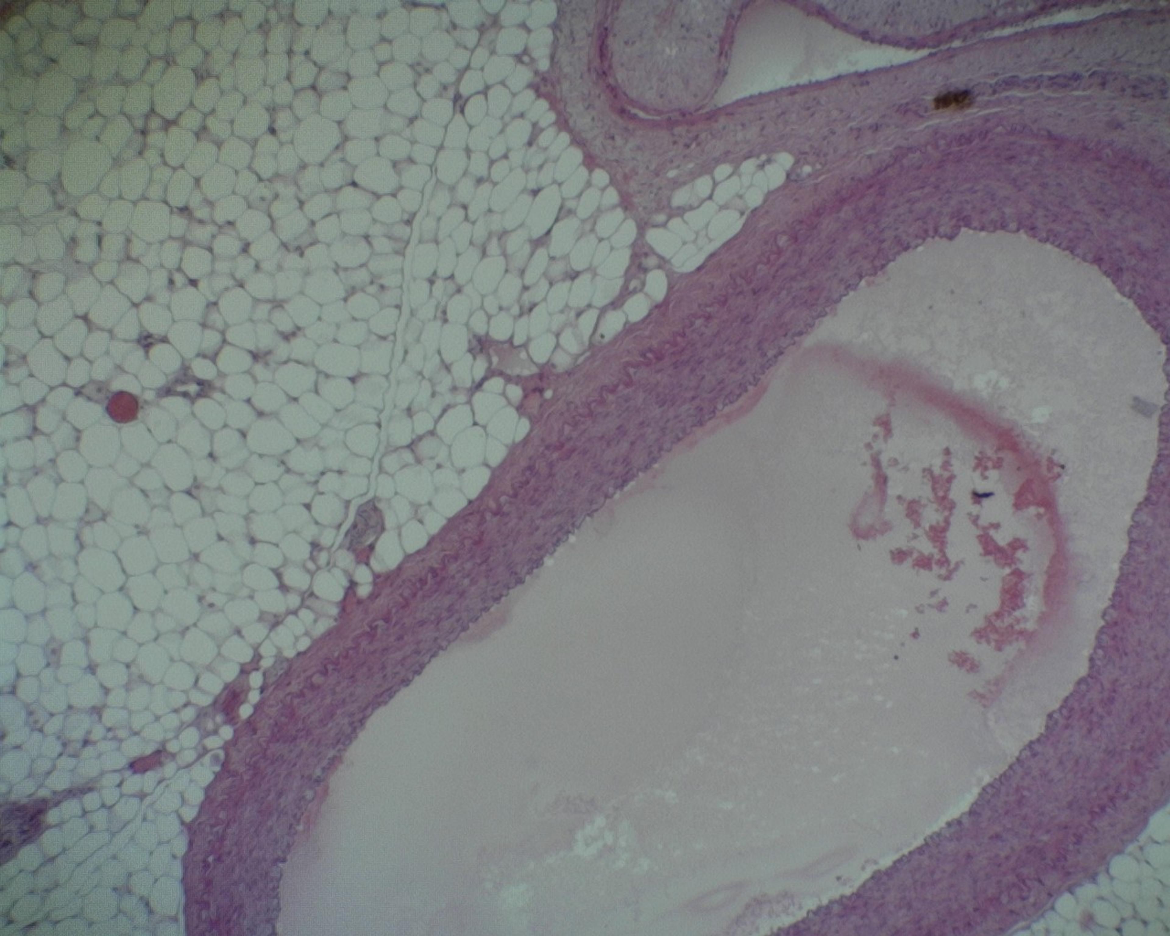 Prepared Microscope Slide - Aorta and Vein T.S.