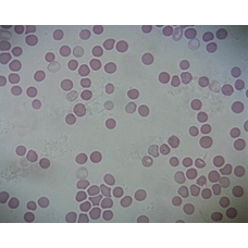 Prepared Microscope Slide - Human Blood Smear
