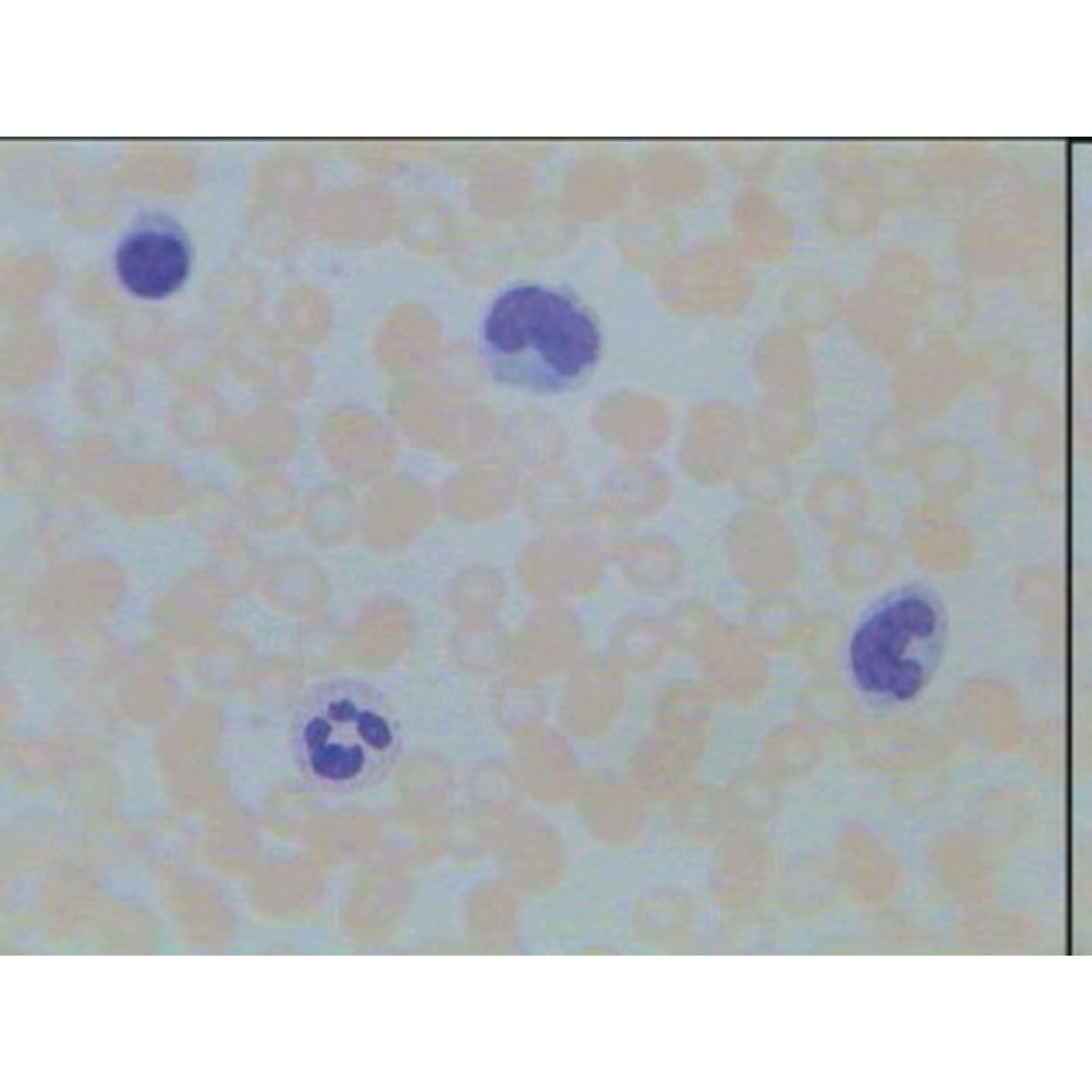 Philip Harris Prepared Microscope Slide - Liver  (Injected Section)