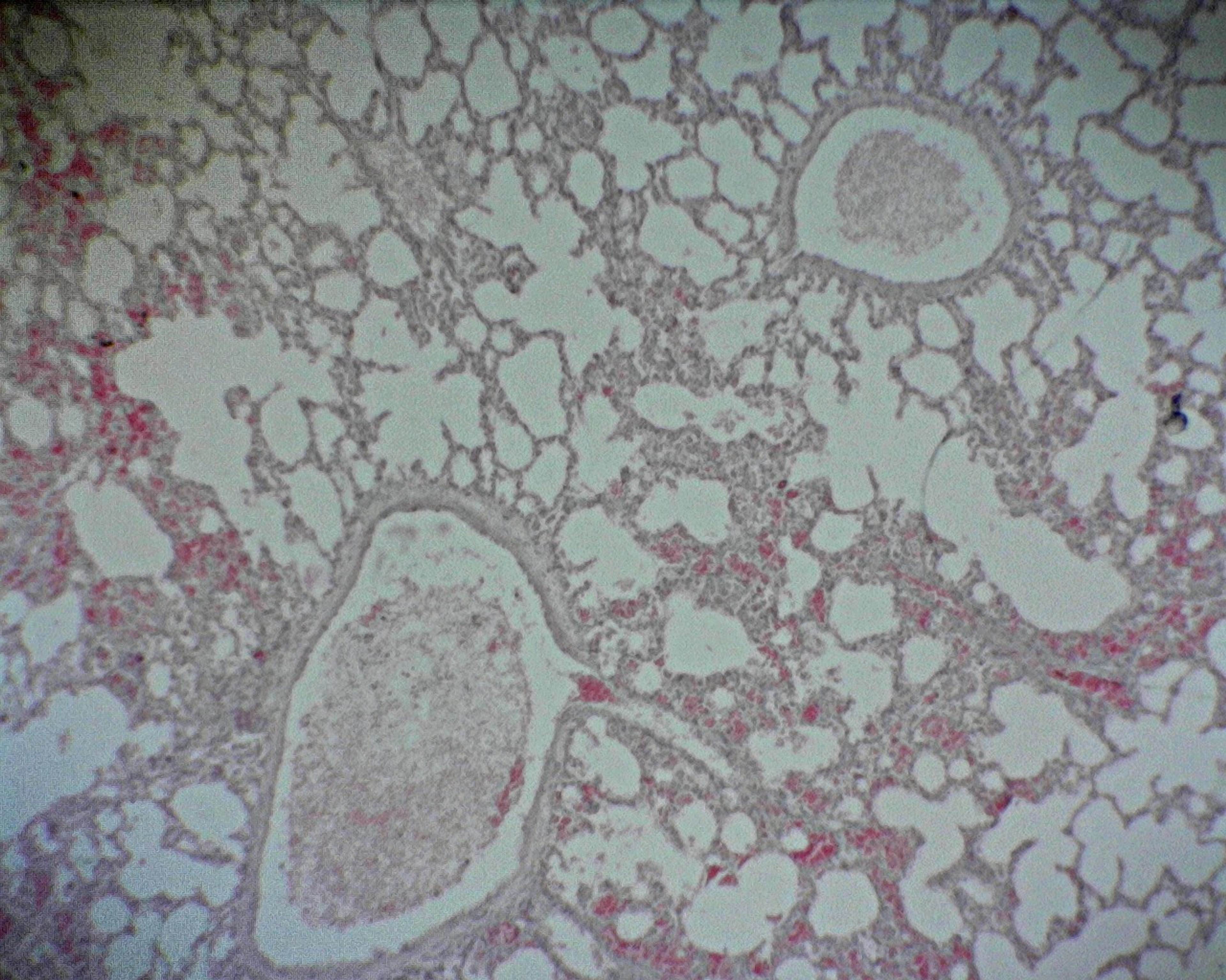 Philip harris Prepared Microscope Slide - Lung - for Elastic and Collagen Fibres of Alveolar Walls T.S.