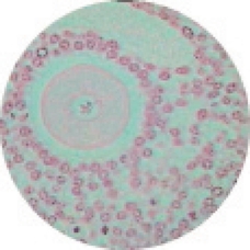 Prepared Microscope Slide - Ovary, Thin Section 