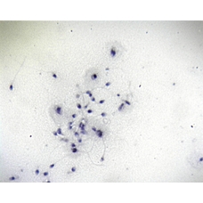 Philip Harris Prepared Microscope Slide - Human Spermatozoa Smear