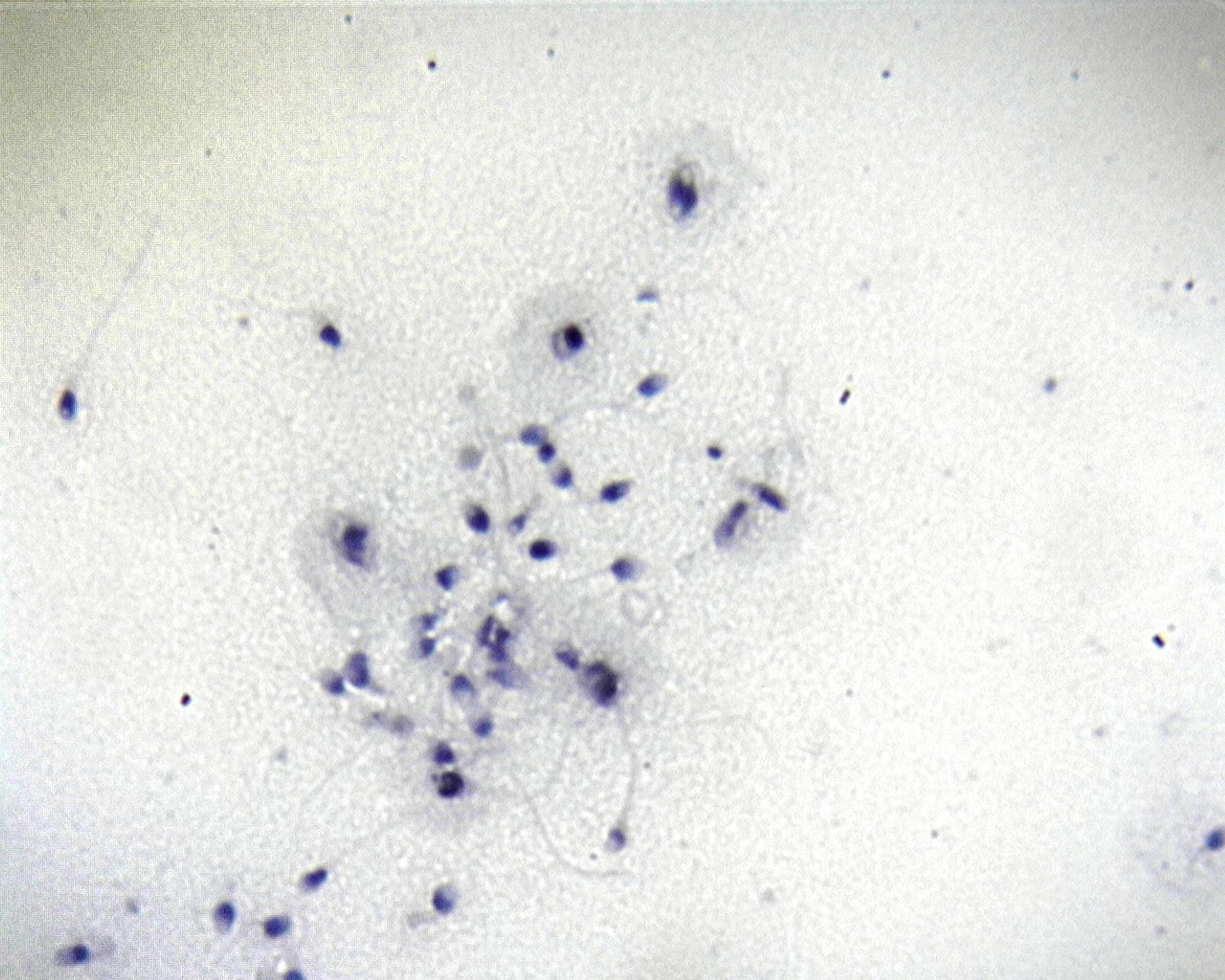 Philip Harris Prepared Microscope Slide - Human Spermatozoa Smear