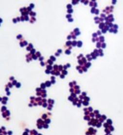 Micrococcus Luteus