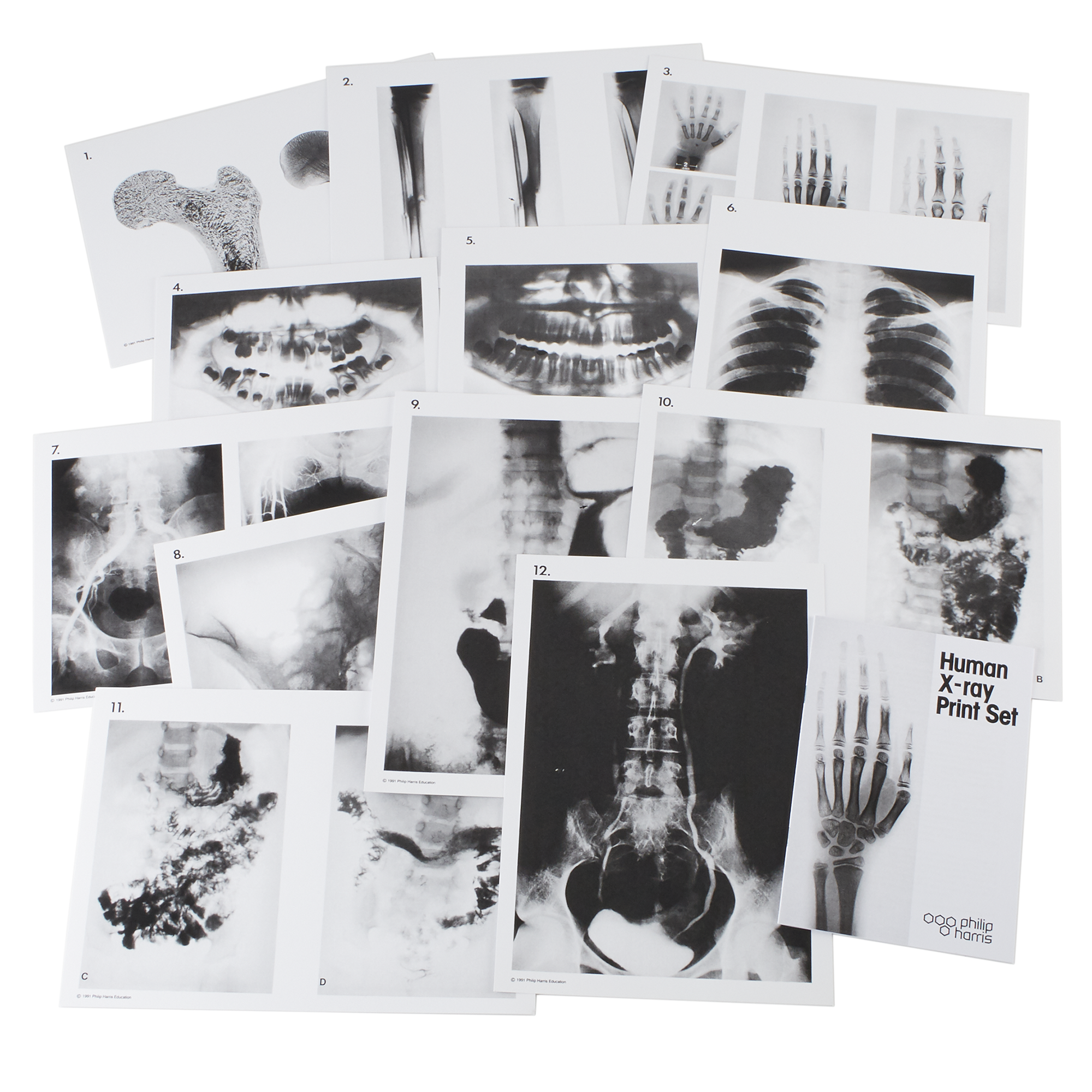 Human X-ray Print Set A4