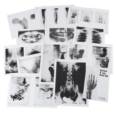 Human X-Ray Print Set - A4