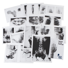 Philip Harris Human X-Ray Print Set - A4
