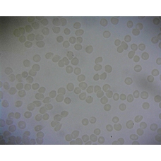 Prepared Microscope Slide - Human Blood Smear (Unstained)