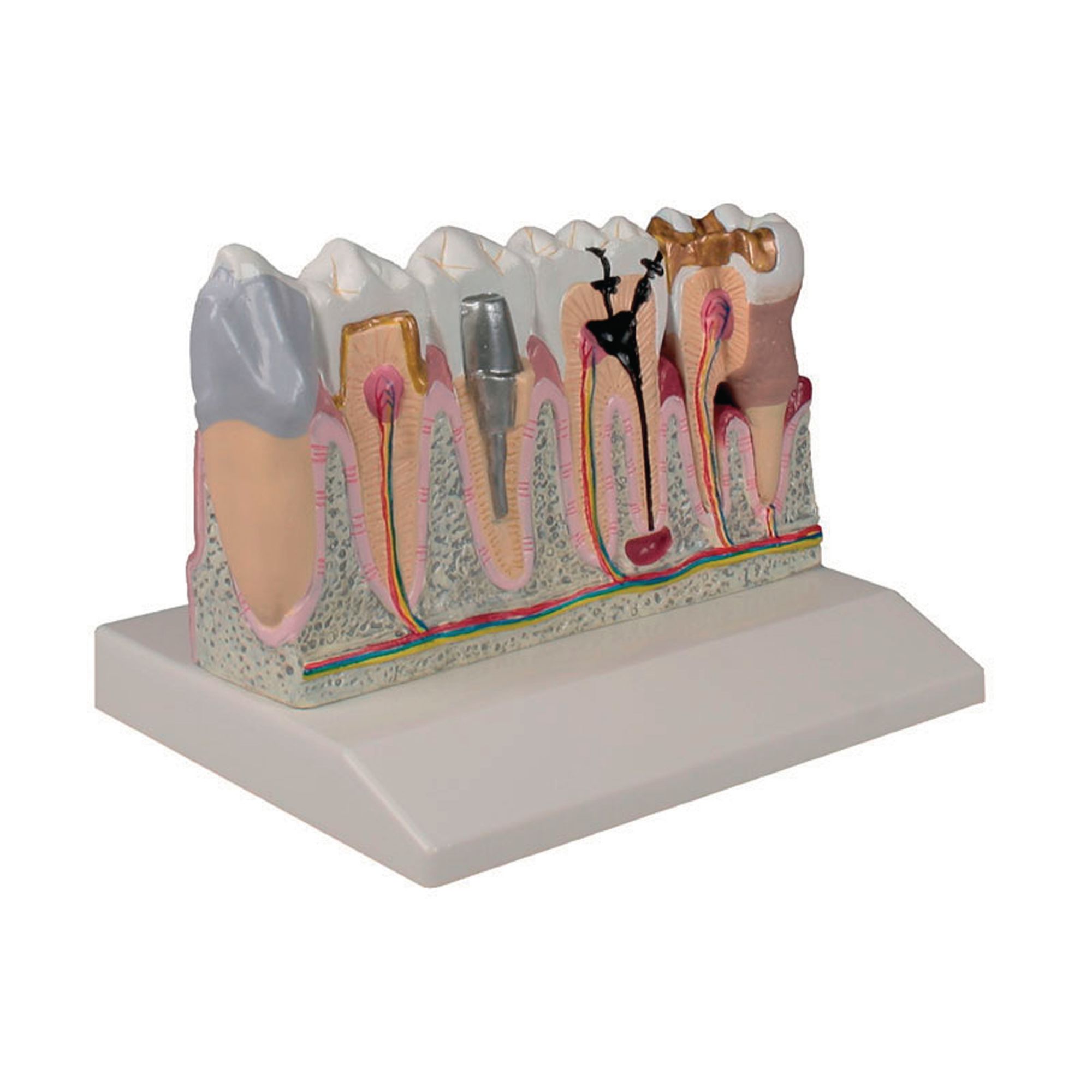 Dental Model 4x Life Size
