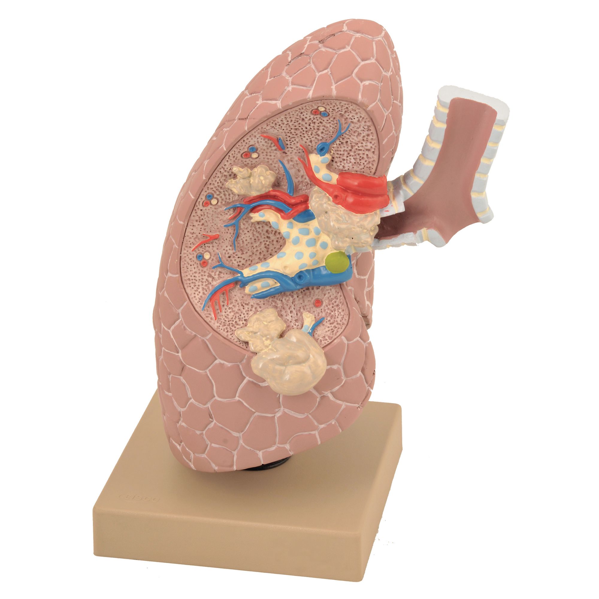 Lung Cancer Model