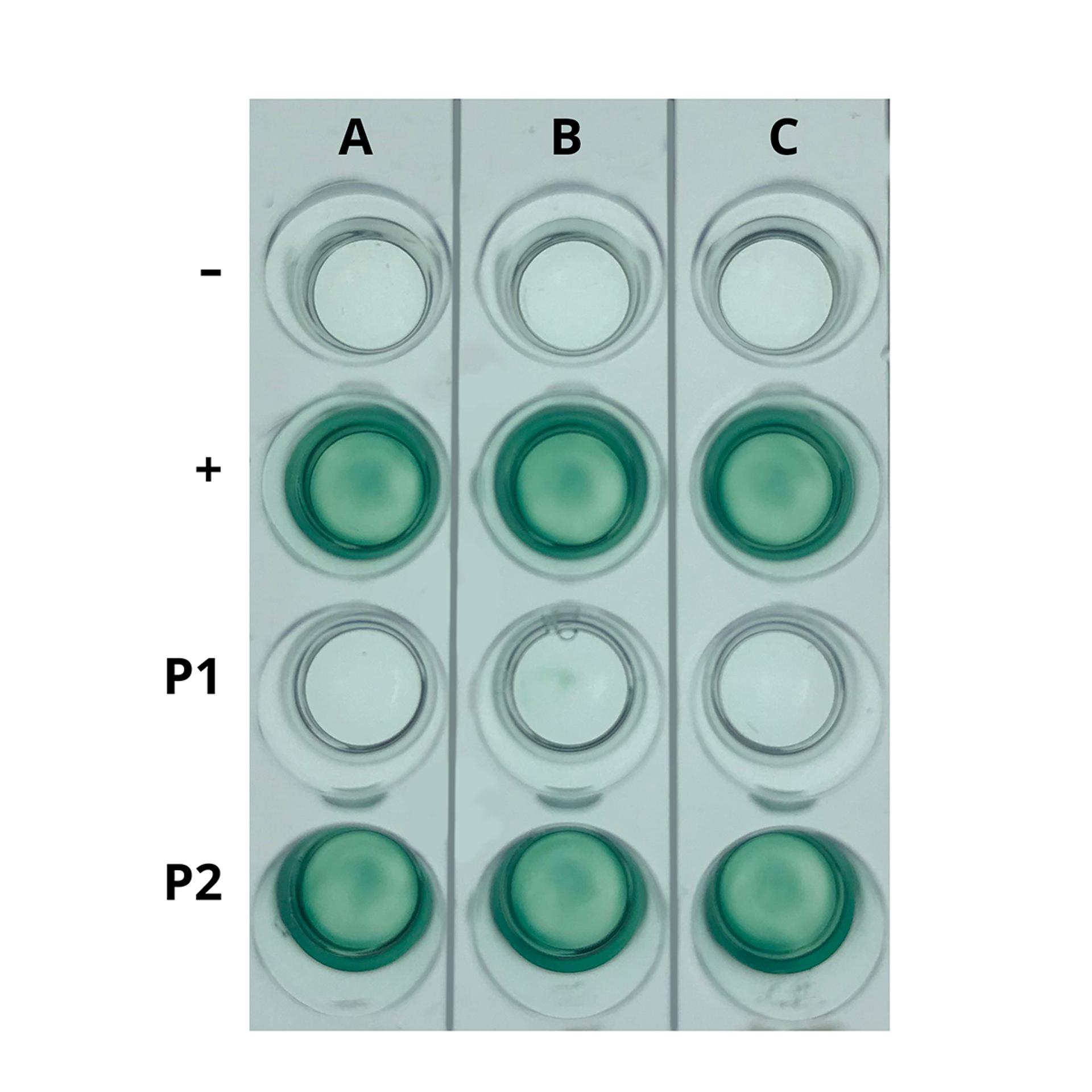 EDVOTEK Simulation of HIV Detection Kit | HC1482338 | Findel International