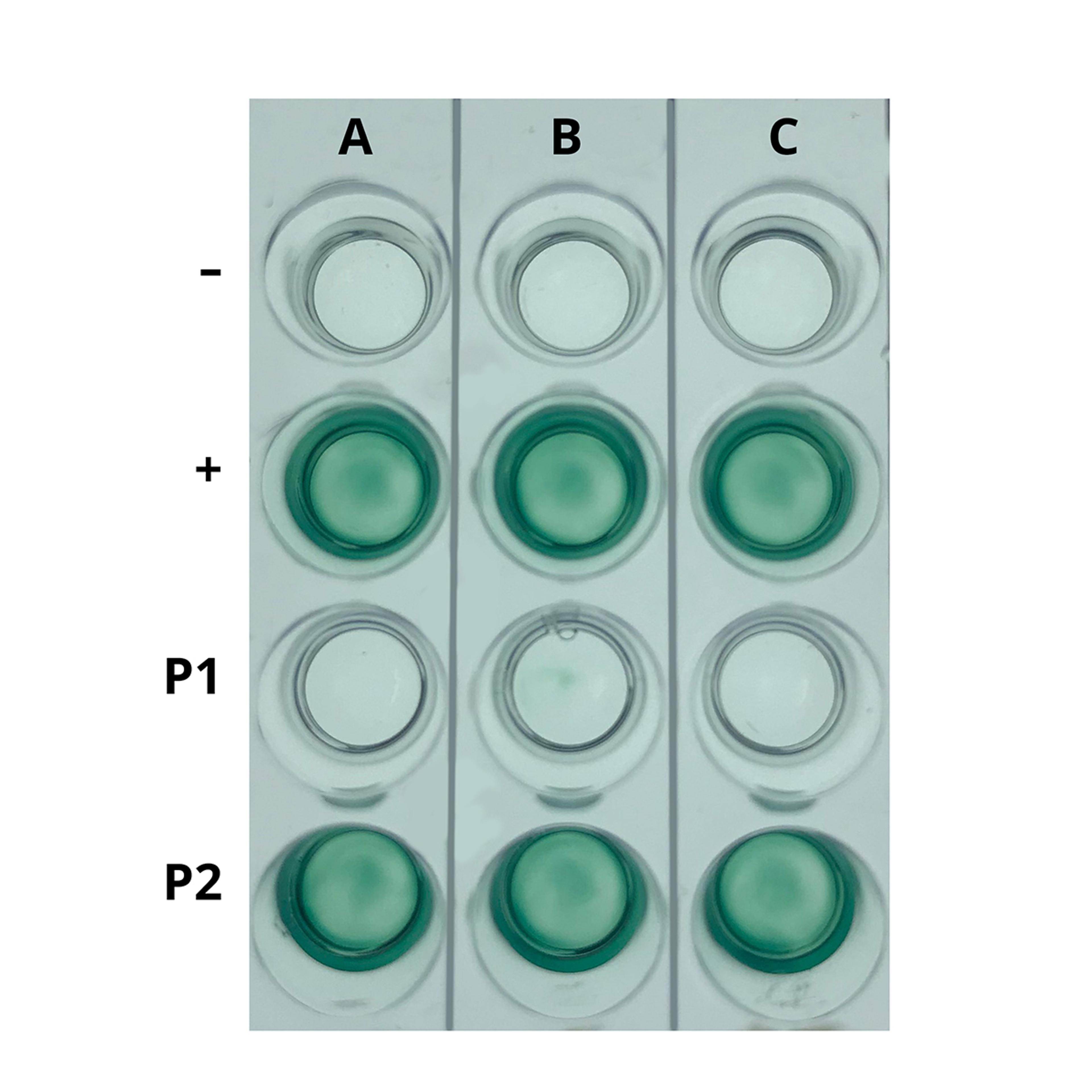 EDVOTEK Simulation of HIV Detection Kit