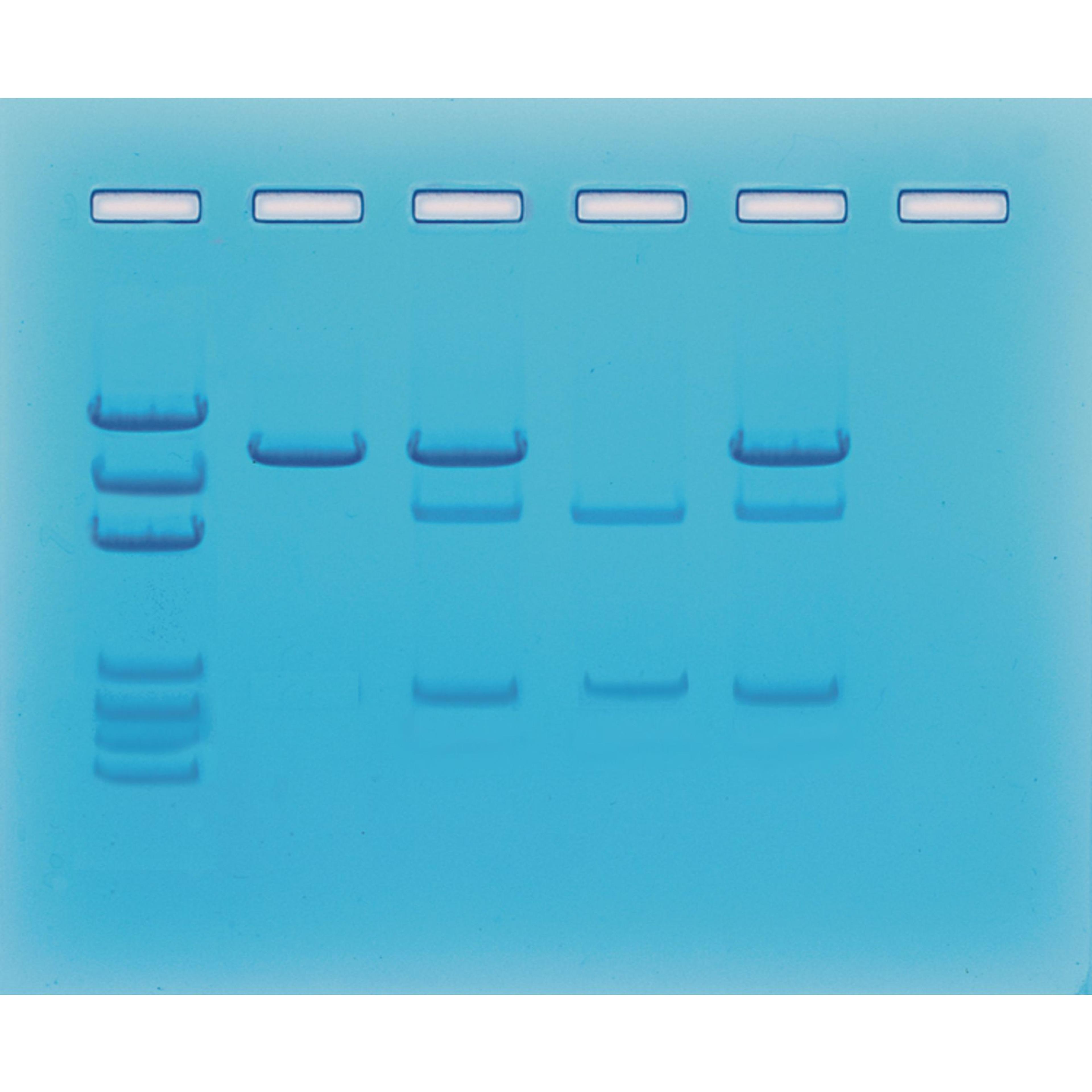 EDVOTEK Cancer Gene Detection Kit