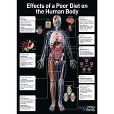 Effects of a Poor Diet On the Body Poster