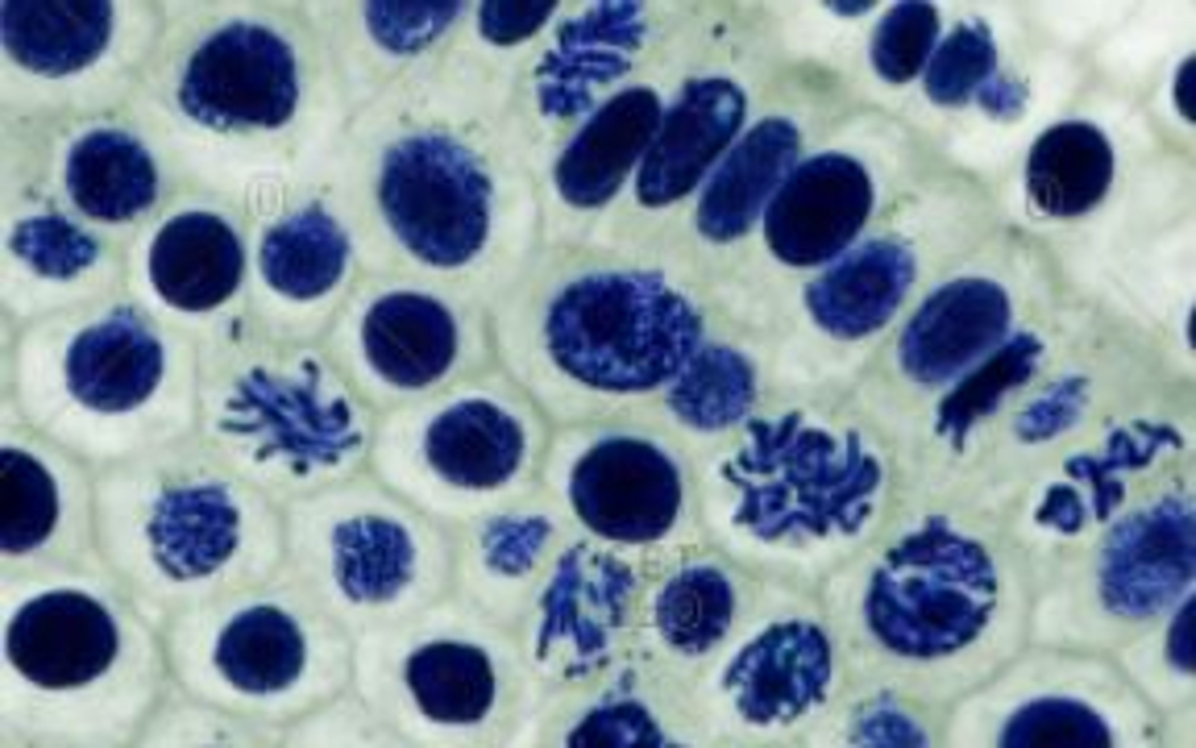 Philip Harris Prepared Microscope Slide Set - Mitosis and Meiosis - Set 1 - Set of 6 Slides