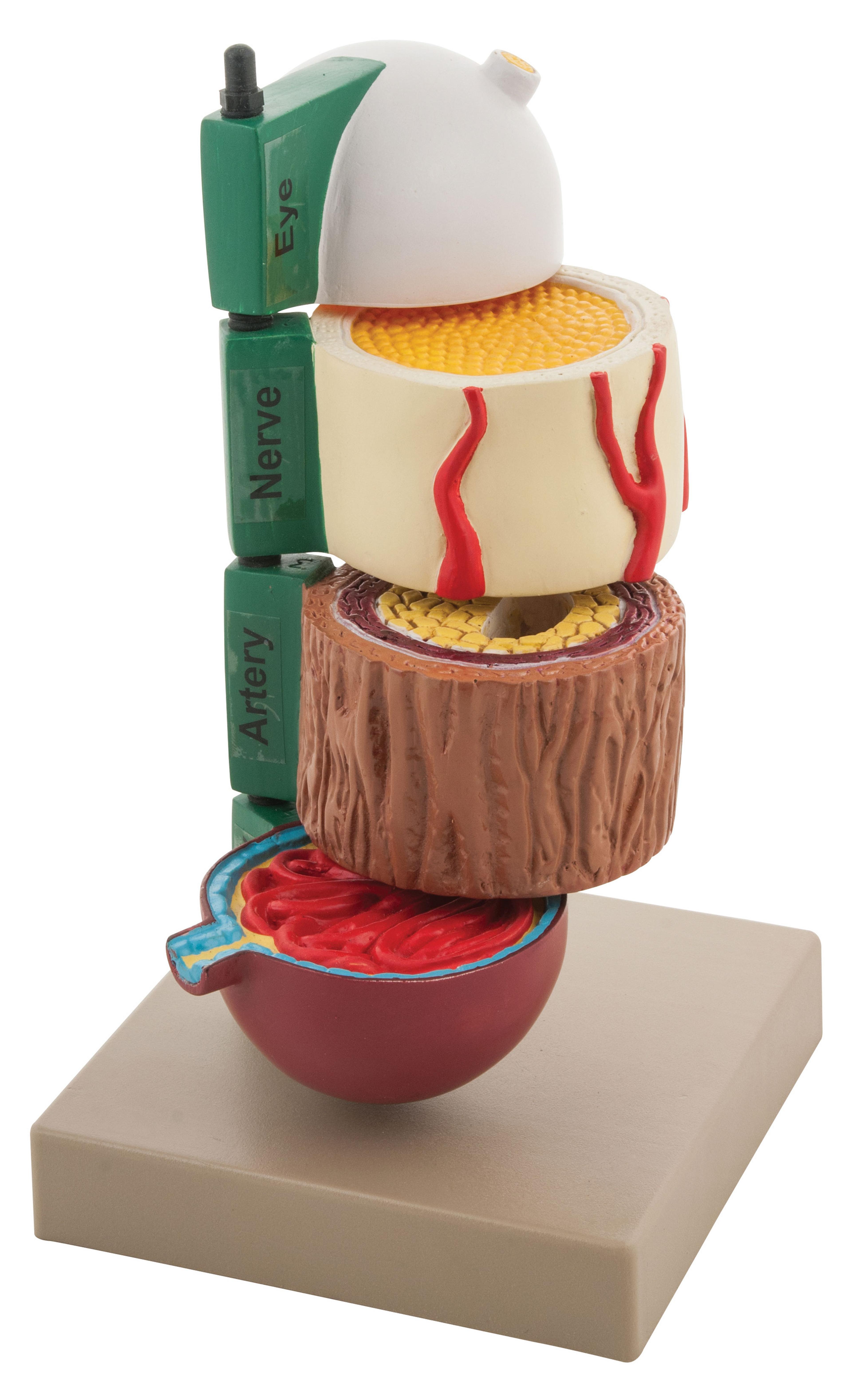 Diabetes Model: 4-Piece