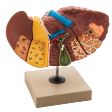 Liver Pathologies Model 