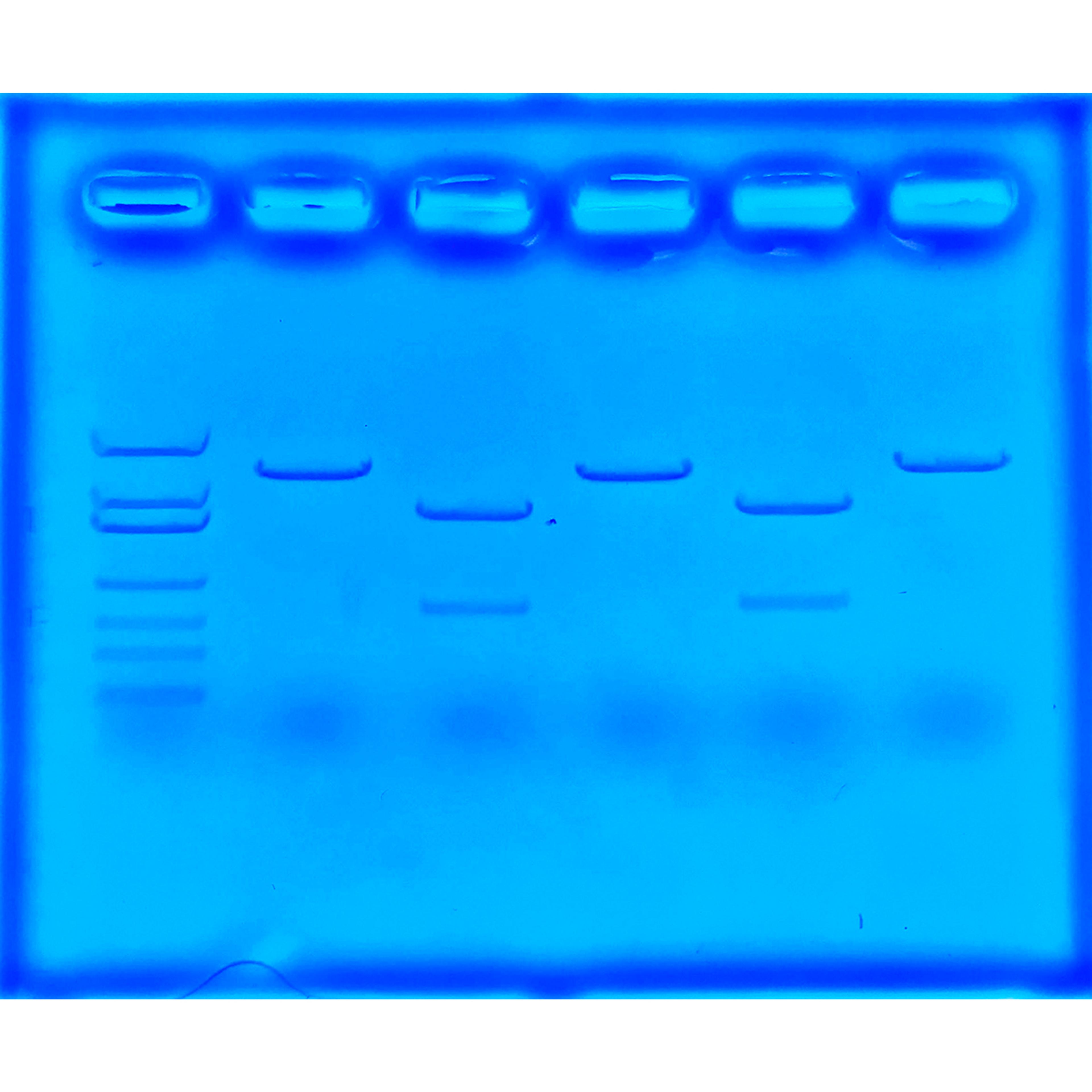 EDVOTEK Using CRISPR to Treat Cystic Fibrosis
