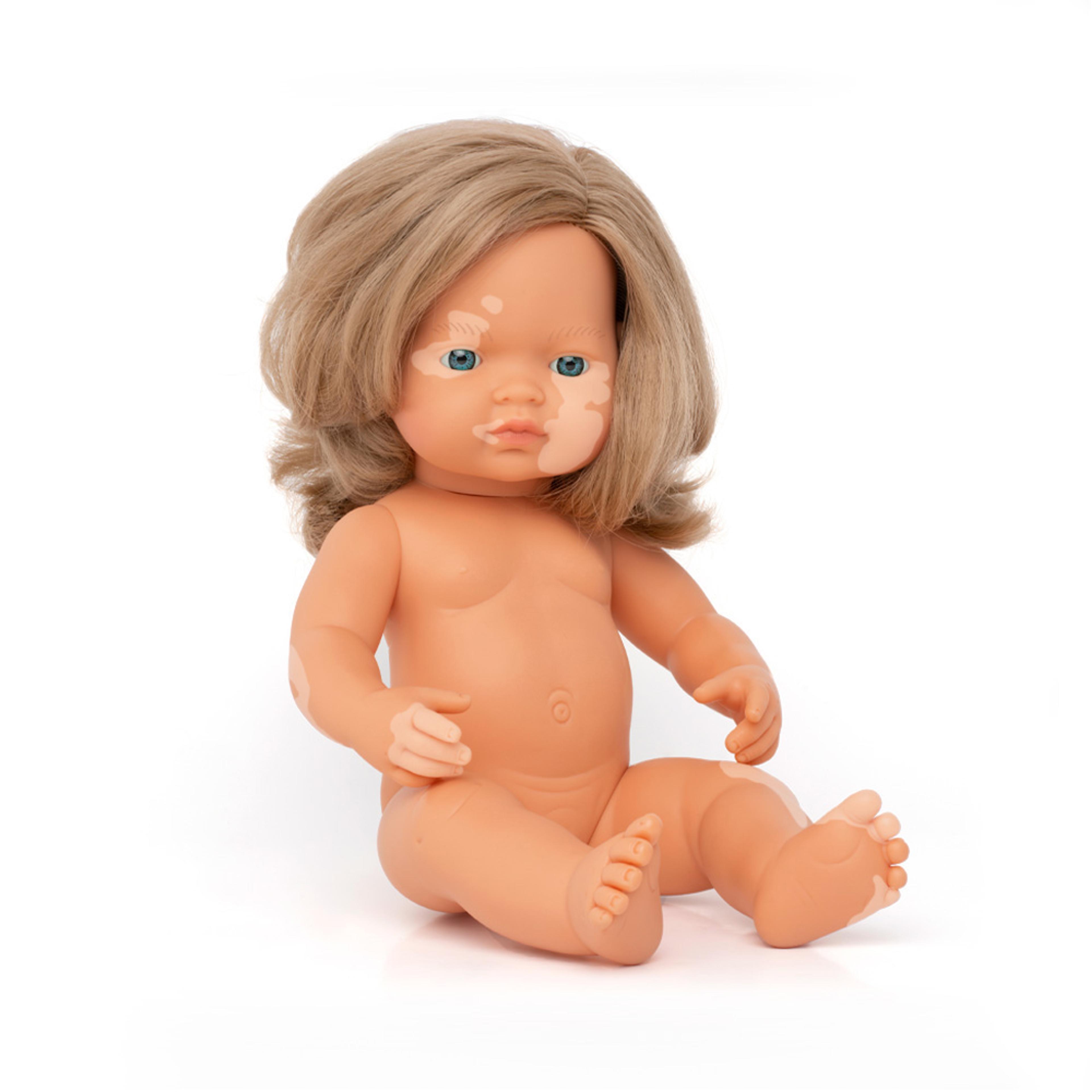 Miniland Doll with Vitiligo