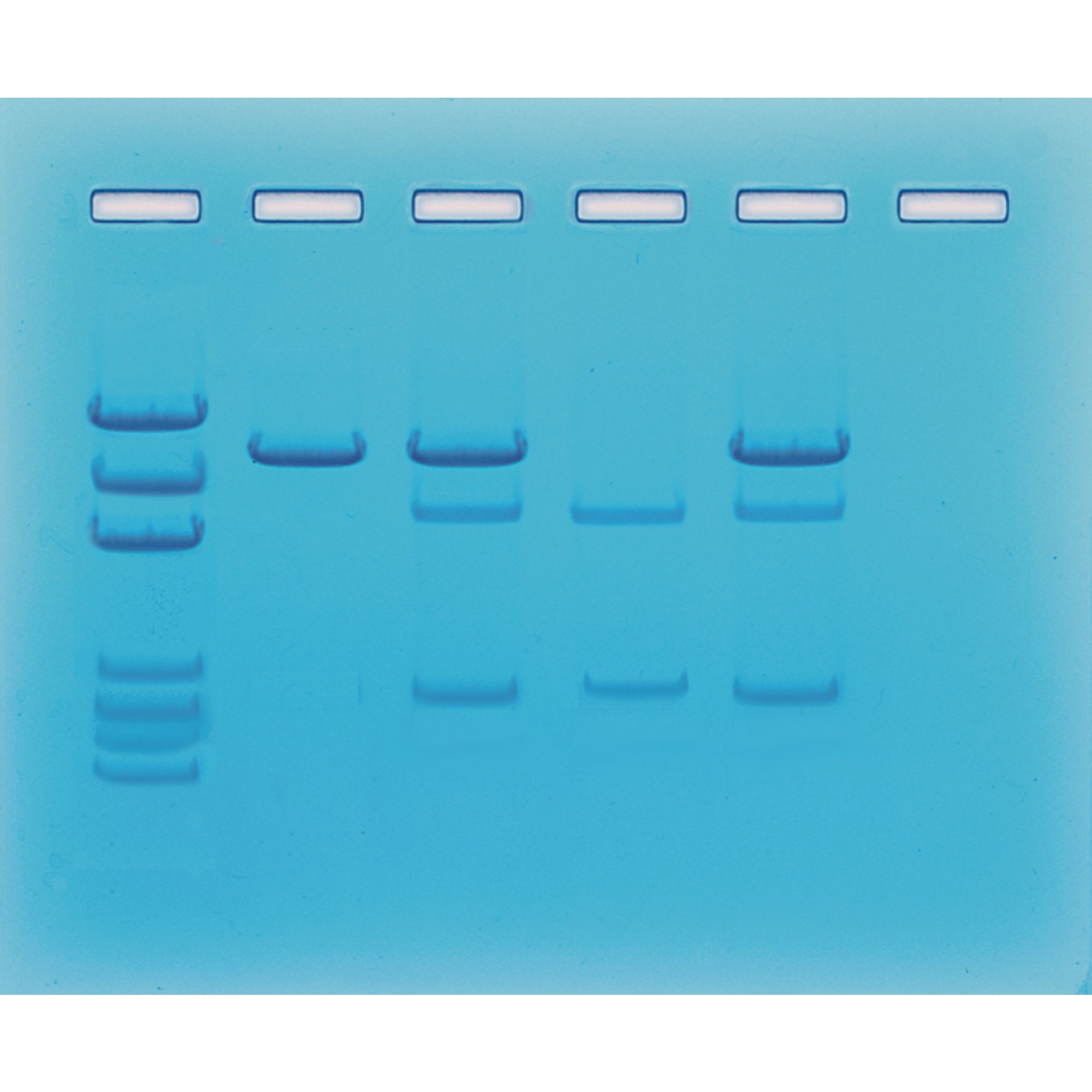 Cancer Gene Detection