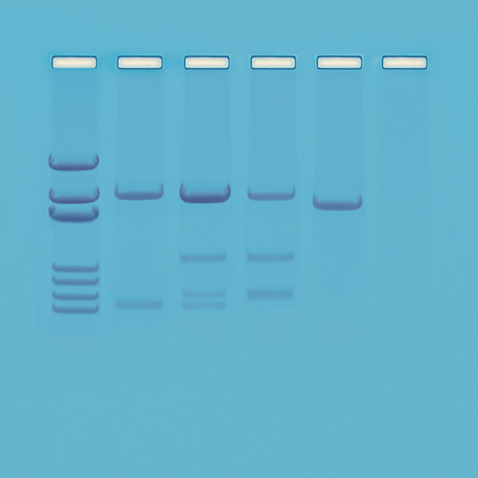 Dna Paternity Testing Simulation